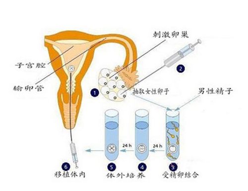 供卵告诉孩子吗【供卵告诉孩子吗:生命的选择与坦诚的沟通】