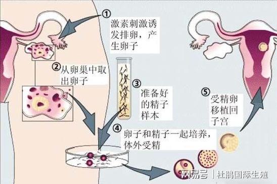 供卵和试管有什么区别(供卵与试管婴儿有什么区别?)
