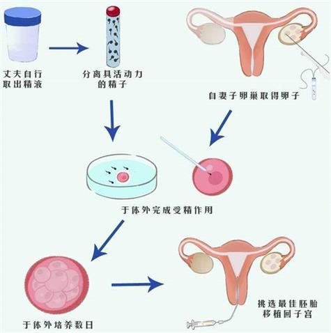 供卵试管需要什么条件-供卵试管：条件是什么？